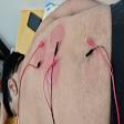 Acupuncture product image