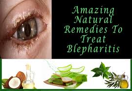 5 Most Effective Natural Home Remedies You Should Try To Treat Blepharitis Right Now Blepharitis Natural Remedies Natural Home Remedies