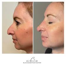 TOP 10 BEST Cosmetic Surgeons in Vicksburg, MS