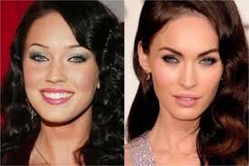 Криштиану роналду до и после пластических операций 2. Izvestnyj Futbolist Krishtianu Ronaldu Do I Posle Plastiki