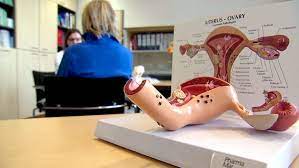 Im darm etwa sollten polypen so früh wie möglich erkannt und entfernt werden. Wann Ist Eine Gebarmutterentfernung Sinnvoll Ndr De Ratgeber Gesundheit