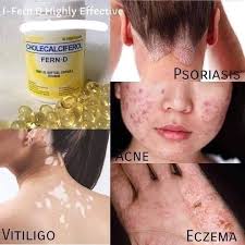 Profile for Ifern-authorized distributor