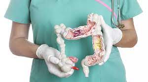 La péritonite est caractérisée par une inflammation ou une infection aiguë du péritoine, enveloppe qui entoure l`ensemble des viscères contenus dans la cavité abdominale. Appendicite Et Peritonite Priorite Sante