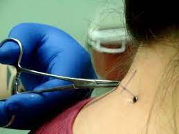 Pin On Nape Piercings