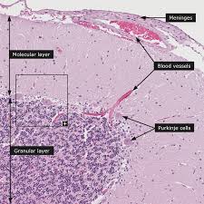 Fetal leg, cross section, h&e, 40x (bone marrow in tibia and fibula, developing blood cells, sinusoids, megakaryocytes). Dictionary Normal Cerebellum Medical School Notes Human Anatomy And Physiology Medical School Studying