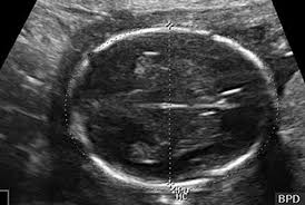 hafta hafta gebelik gelisimi 18 haftalik gebelik donemi canbebe blog