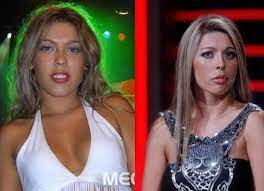La decoradora, daniela aránguiz, recordó en ph podemos hablar sobre la extorsión que sufrió su mientras se hacía un masaje, daniela aránguiz detectó una inflamación en su abdomen y decidió. Daniela Aranguiz Detallo Cada Una De Las Cirugias A Las Que Se Ha Sometido Guioteca