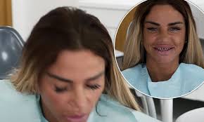 Katie price compared herself to bond villain jaws while showing off her real teeth ahead of a veneer replacement. Katie Price Spits Out Old Teeth As She Gets Her Veneers Replaced Daily Mail Online