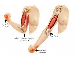 Cubital Tunnel Syndrome Star Physical Therapy Tennessee Tn