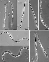 Image result for Raphidiocystis