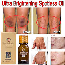 Skin Spots Removal Lightening Cream Ele Buy Online In Faroe Islands At Desertcart