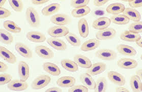 Clinical And Laboratory Manual Of Implant Overdentures