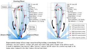In human anatomy of the leg, the femoral sheath has three compartments. Specific Contribution Of Hip Abductor Muscle Strength To Turning Movement In Individuals With Knee Osteoarthritis Osteoarthritis And Cartilage