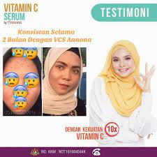 We did not find results for: Serum Vitamin C Annona Menjadikan Wajah Flawless Jus Annona Khasiat Jus Durian Belanda Organik