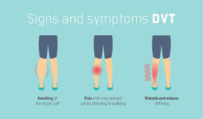 Warning Signs For Dvt Cancerclot Vein Thrombosis Deep Vein Thrombosis Thrombosis
