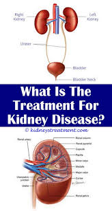 Pin On Kidney Disease Stages
