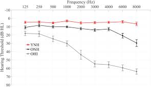 representation of speech in noise in the aging midbrain and