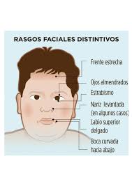 Rasgos Faciales Distintivos