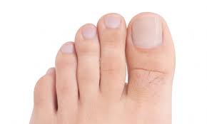 ¿has visto a alguien por la calle con las uñas de los pies súper largas? Consejos Para Cortar Las Unas De Los Pies Podoactiva Lideres En Podologia