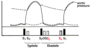 Techniques Heart Sounds Murmurs Exam Physical