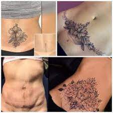 130 Ideas De Abdominoplastia Tattos Tatuaje En Cicatriz Tatuaje Para Cubrir Cicatriz Tatuaje Para Tapar Cicatriz