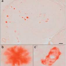 Ethyl orange sodium salt, 92%, indicator. Typical Congo Red Staining In A 22 Month Tg2576 App Transgenic Download Scientific Diagram