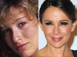 Today's cosmetic surgery is so advanced that it is hard to imagine any celebrity not being influenced by the miracles that surgery can bring. Celebrity Plastic Surgery Disasters Cbs News