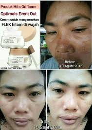 Punya masalah flek hitam di wajah karena pengaruh sinat uv matahari atau hormonal?. Oriflame Sweden Inicio Facebook