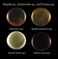 Hektoen enteric agar salmonella morphologies. Bismuth Sulfite Agar Wikipedia