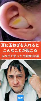 玉ねぎは万能薬 玉ねぎは食材としてだけでなく 他にも色々な健康のための素晴らしい効能を持っています 欧米では古くから生活に取り入れられている 玉ねぎを使った民間療法を8つご紹介します 玉ねぎ 民間療法 健康 ヘルス 傷跡 スキンケア 日焼け 虫刺され