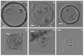 Image result for Entada bacillaris