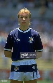 Portrait Of Steve Archibald Of Scotland Before The World Cup Match Against West Germany At La Corregidora Stadium In Quereta World Cup Match World Cup Scotland