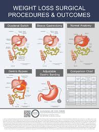 Compare Procedures Dssurgery