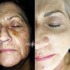 Andri Richter Skin Clinic