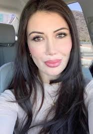 Lorry Hill (plastic surgery YouTuber) : r/VindictaRateCelebs