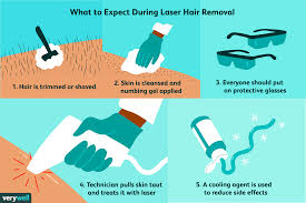 laser hair removal benefits safety