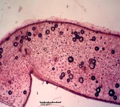 Image result for Calyptrochilum christyanum