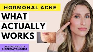 Conquer Acne With Dr. Huma Afzal!
