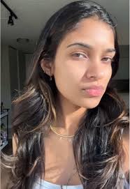 ✨ Real results, real peeling. ✨ The VI Peel is our medical-grade chemical  peel for fading pigment, smoothing texture, and boosting brightness. Expect  visible peeling around days 3–5, with your renewed ...