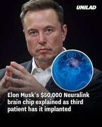 He hopes to implant it in 30 more people this year 😳