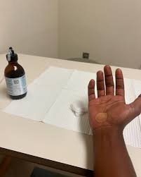 Image result for Hand Injection