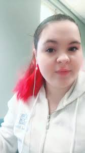 red spot above my lip is cause i lick my lips when its cold out its not  herpes jeez😒