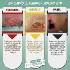 We did not find results for: Bassa Intensita Laser Terapia Sulla Guarigione Delle Ferite Di Pressione In Pazienti In Icu Revista Cientifica