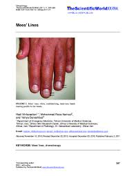 Image result for Mees Line