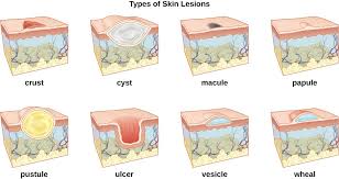 Anatomy And Normal Microbiota Of The Skin And Eyes