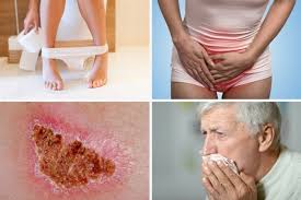 Para el melanoma específicamente, una forma fácil de recordar. 12 Signos Y Sintomas De Alarma De Cancer Que No Debe Ignorar Tua Saude