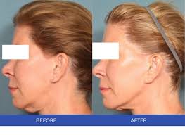 Treiber Dermatology Associates