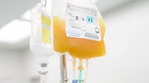 IV bag of platelet concentrate hanging on a pole with tubing, clinical transfusion setup