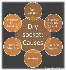 What Is Dry Socket Dry Socket Dry Socket Symptoms Dental