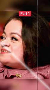 Er Brittle Bone Disease Episode